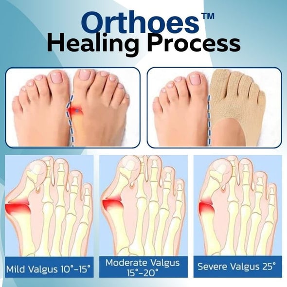 Orthoes™ ortopéd zoknik