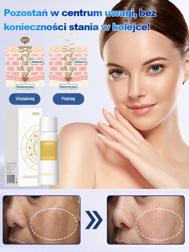 Różne plamy znikają Spray wybielający do usuwania plam