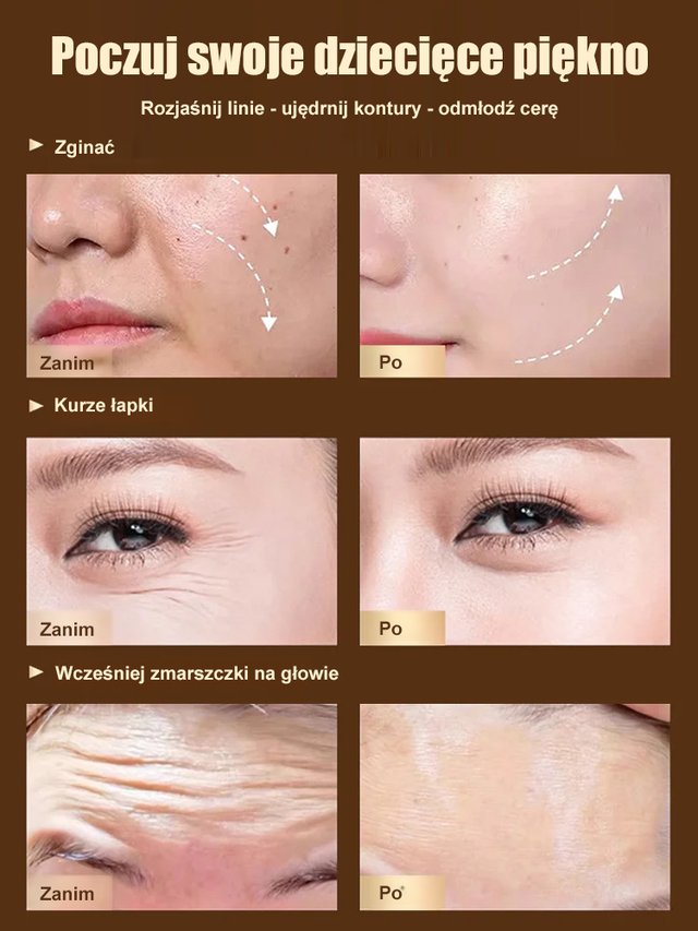 [Usuwanie zmarszczek] Dr. Yunmei Bozen serum przeciwzmarszczkowe