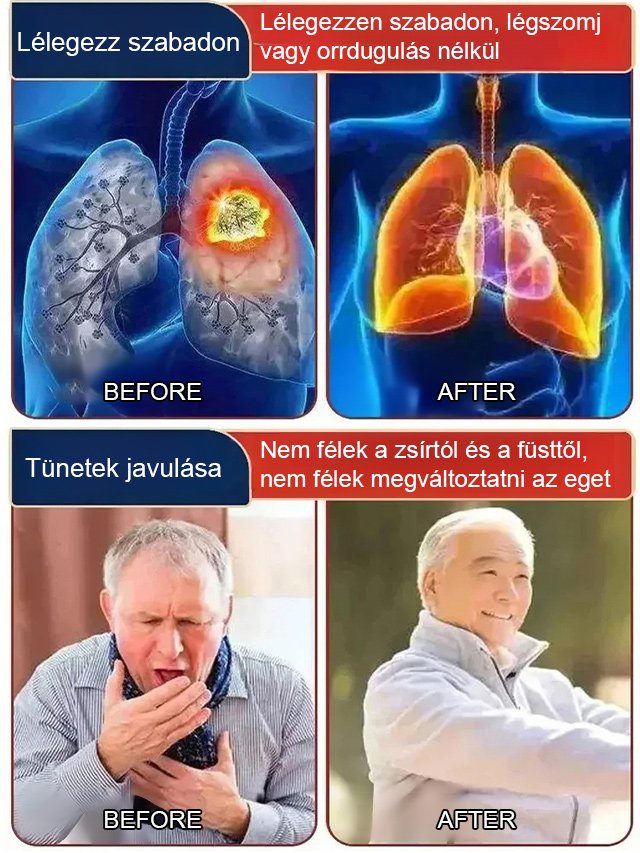 Yunnan gyógynövény quercetin narancsvörös spray