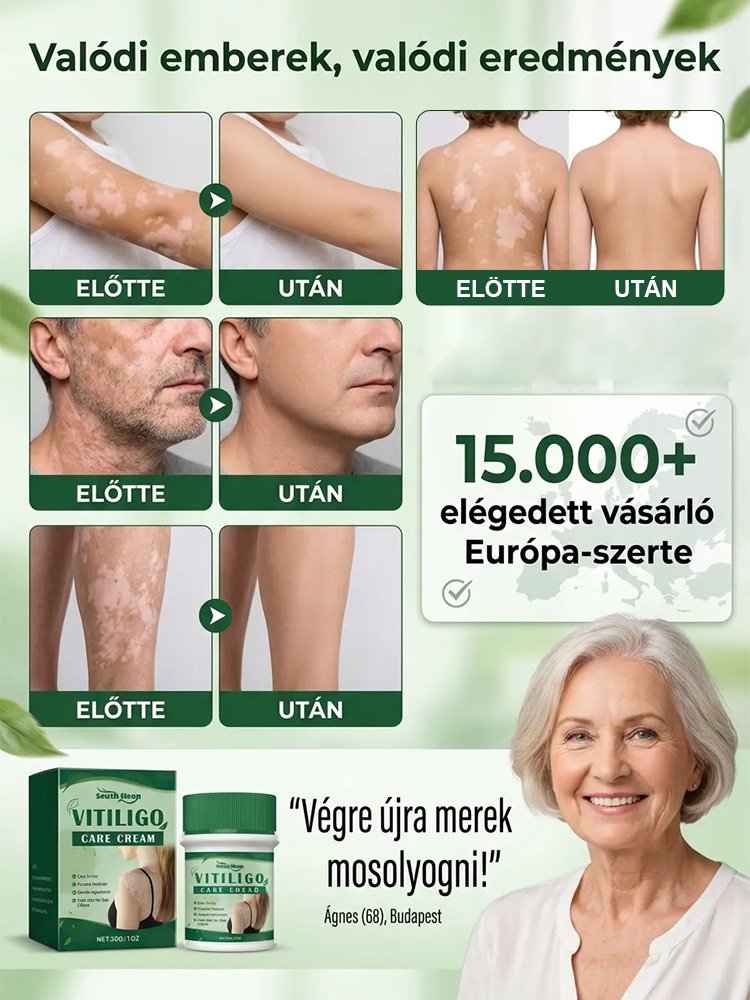 Fehér foltok azonnali eltüntetése, hormonmentes orvosi bőrápoló krém