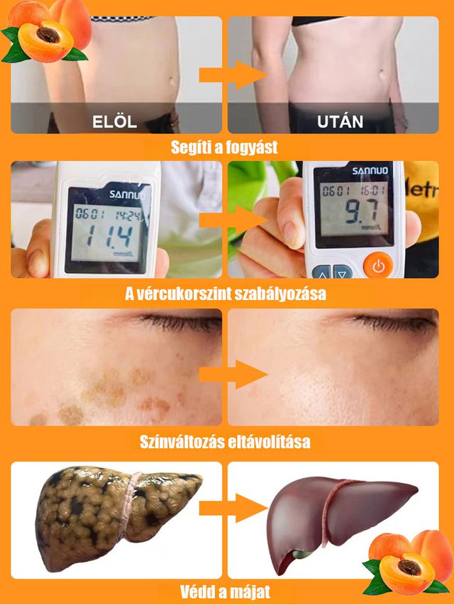 【Óriási császár kajszi】Bőségesen termő, könnyen élő kajszibarackfa csemete