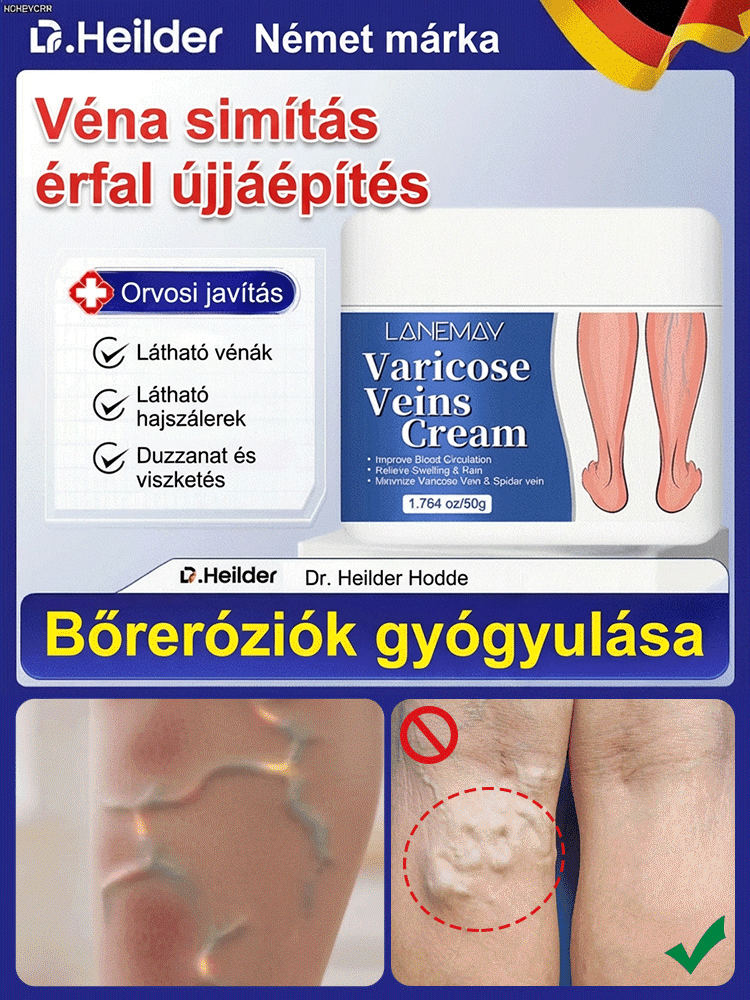 A láb visszér ápoló krém