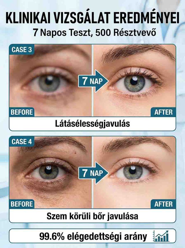Fáradt szemek nyugtató ápoló permet
