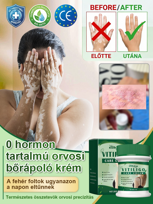 Fehér foltok azonnali eltüntetése, hormonmentes orvosi bőrápoló krém