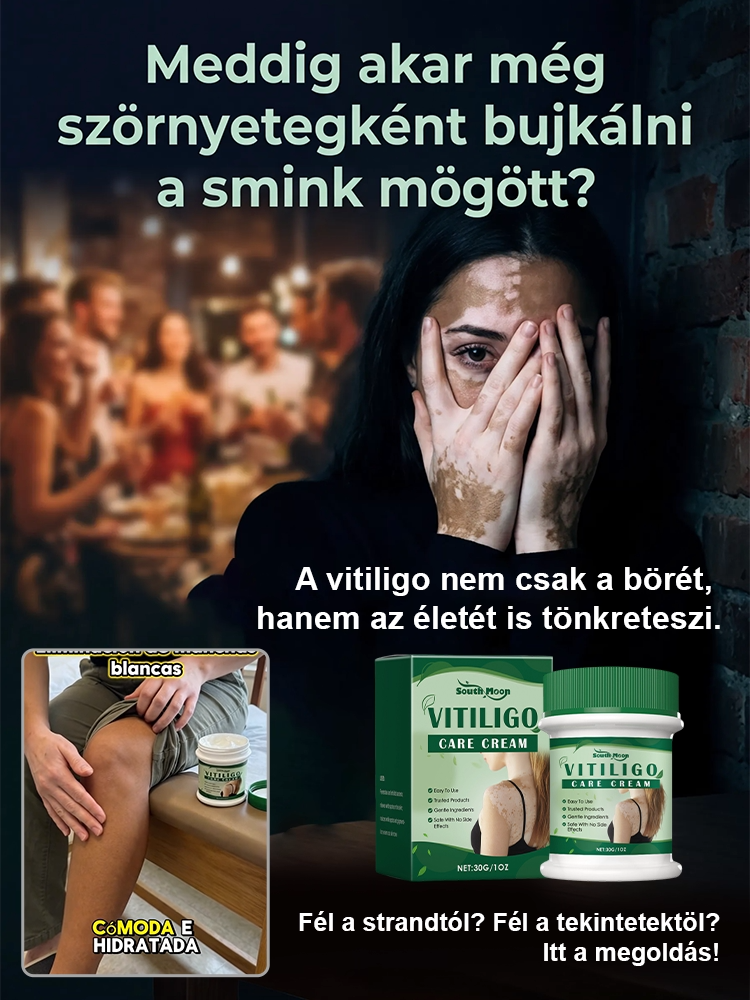 Fehér foltok azonnali eltüntetése, hormonmentes orvosi bőrápoló krém